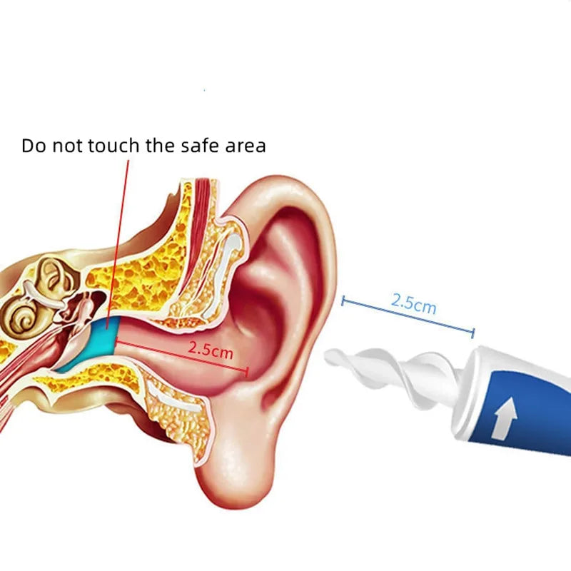 Ear Wax Removal Tool
