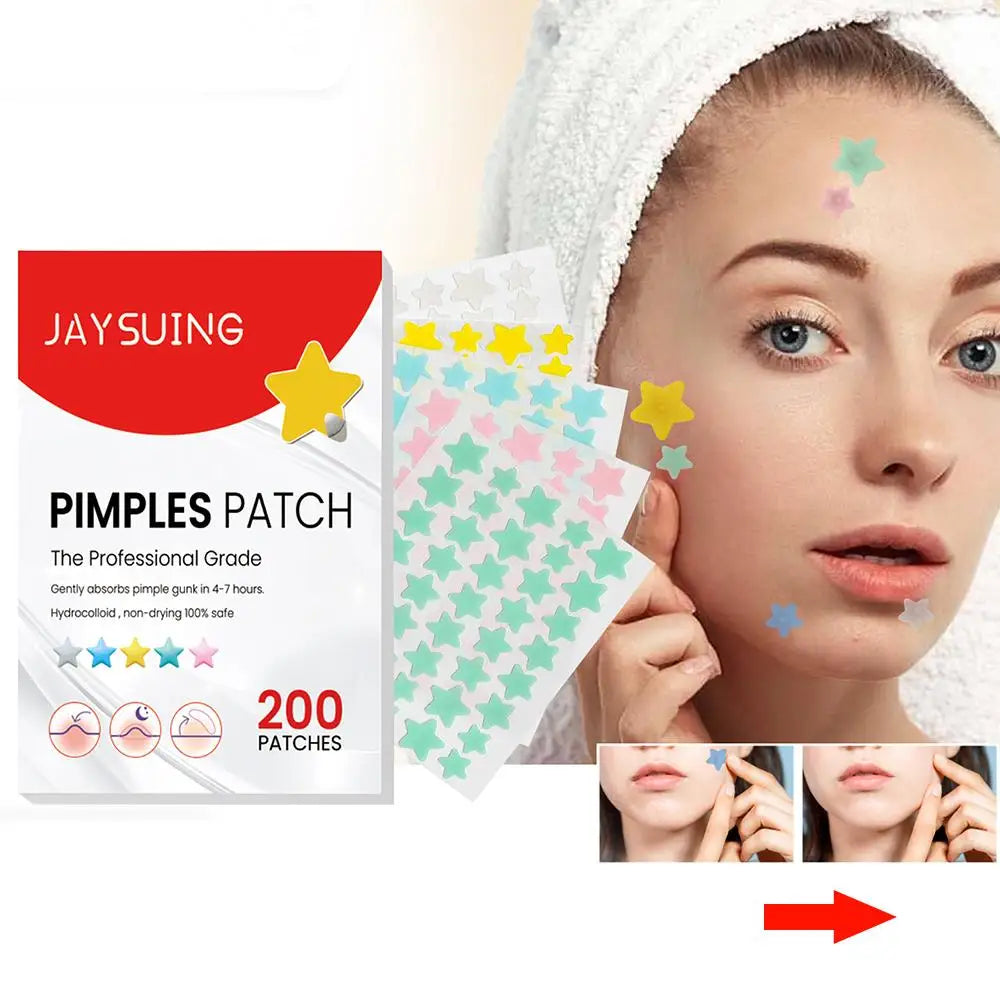 200Pcs Star Pimple Patch Acne Invisible Removal Stickers