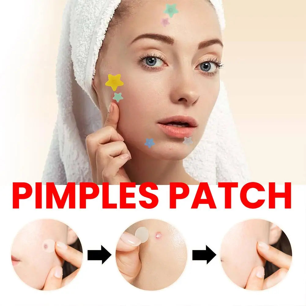 200Pcs Star Pimple Patch Acne Invisible Removal Stickers