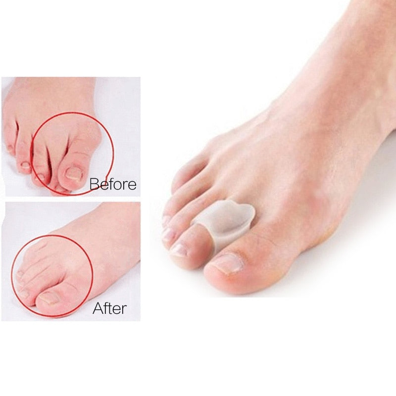 2Pcs=1Pair Silicone Toes Separator