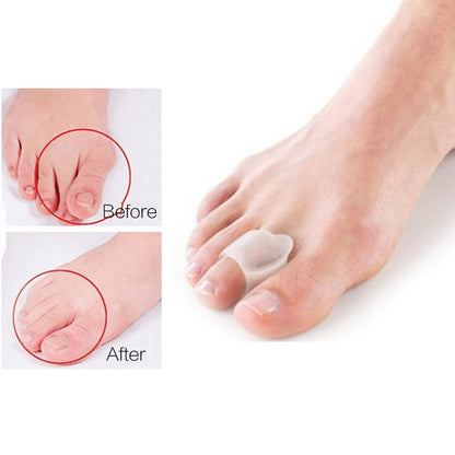 2Pcs=1Pair Silicone Toes Separator