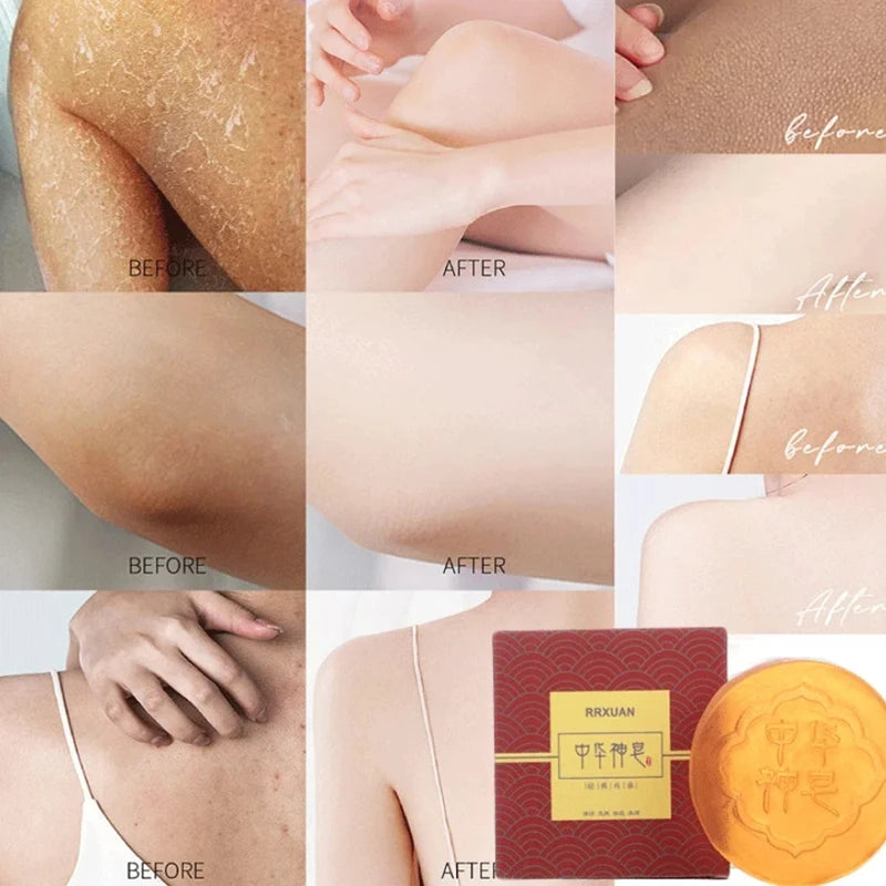 Eelhoe Natural Herb Body Soap