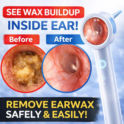 HD Digital Ear Camera Otoscope with Display