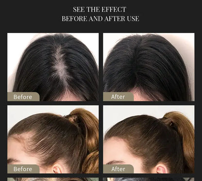 SEVICH Hair Building Fibers Set