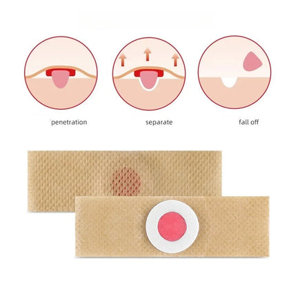 Corn Relief Pads for Calluses & Hard Skin
