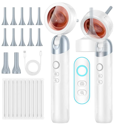 HD Digital Ear Camera Otoscope with Display