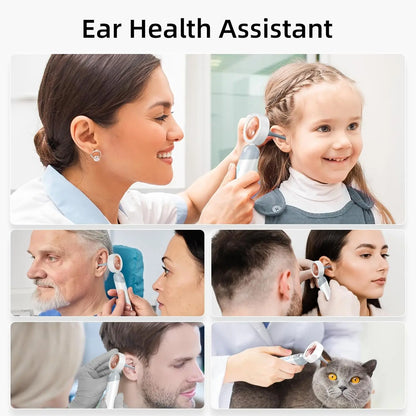 HD Digital Ear Camera Otoscope with Display