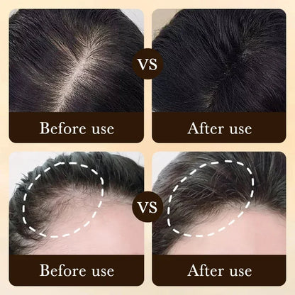 Fast Hair Growth Anti Hair Loss Serum Baldness Repair