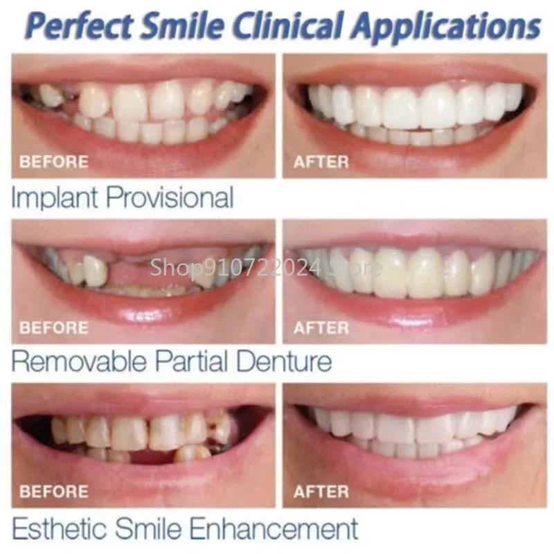 Silicone Teeth Cover Set