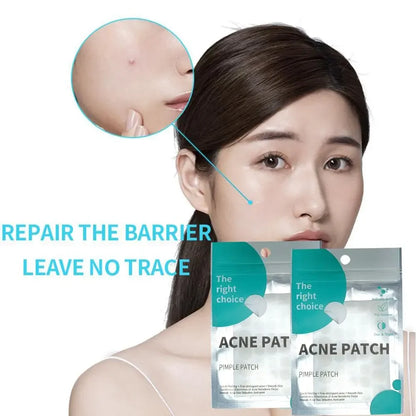 Hydrocolloid Acne Patches for Pimples & Blemishes