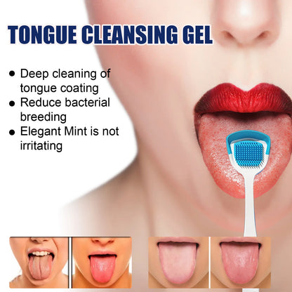 Tongue Cleaning Gel & Brush Kit