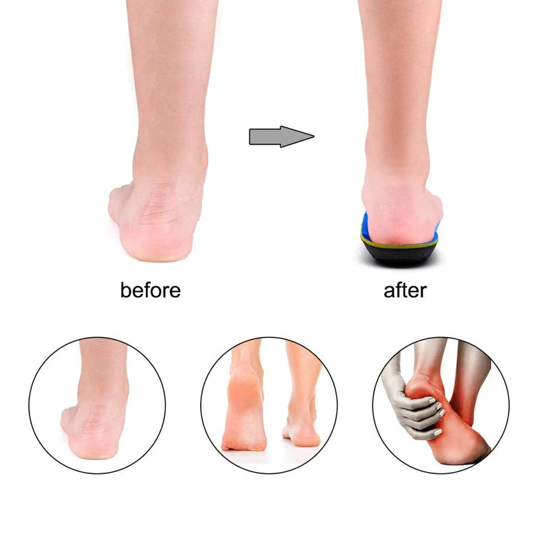 Orthopedic Arch Support Insoles