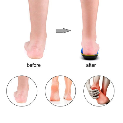 Orthopedic Arch Support Insoles