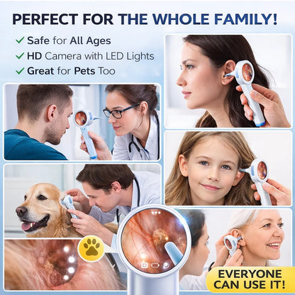 HD Digital Ear Camera Otoscope with Display