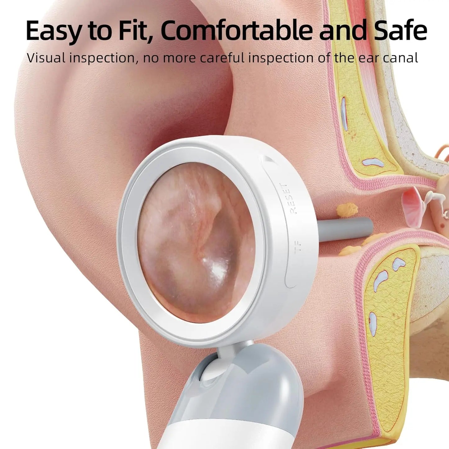 HD Digital Ear Camera Otoscope with Display