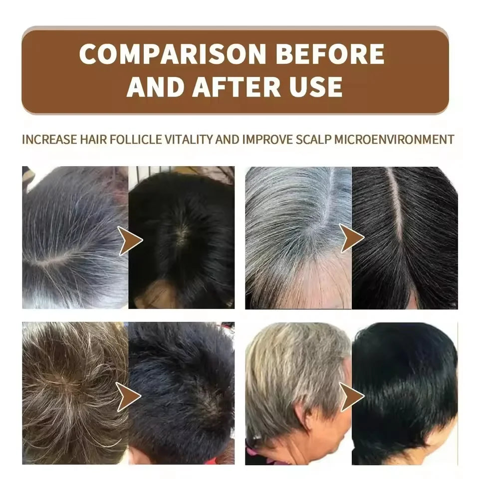 Gray Hair Treatment Serum Spray