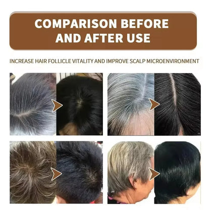 Gray Hair Treatment Serum Spray