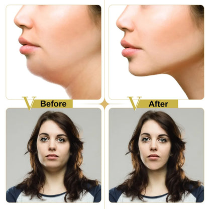 Reusable V Shape Face Lift Mask