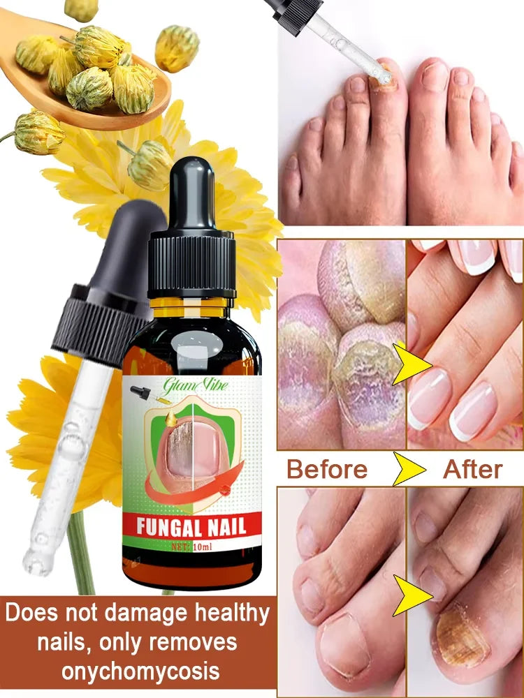 Nail Care Treatment Cream