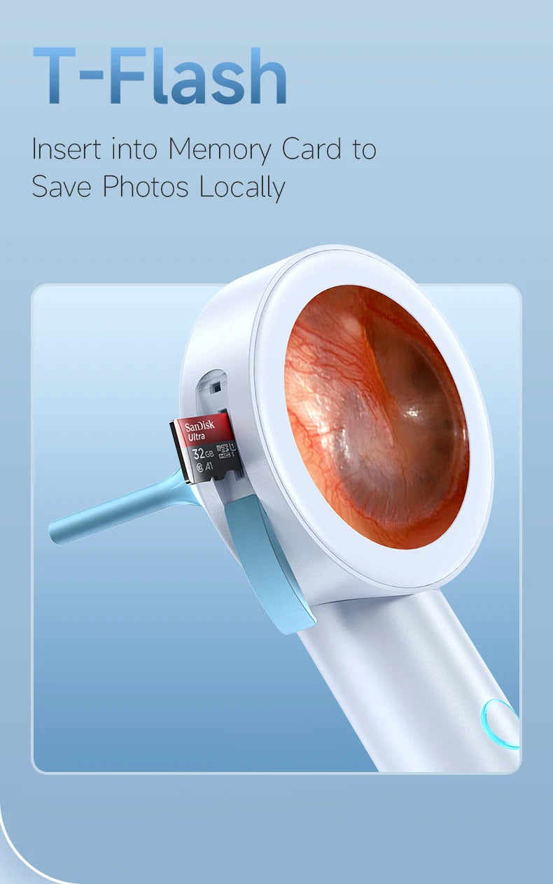 HD Digital Ear Camera Otoscope with Display