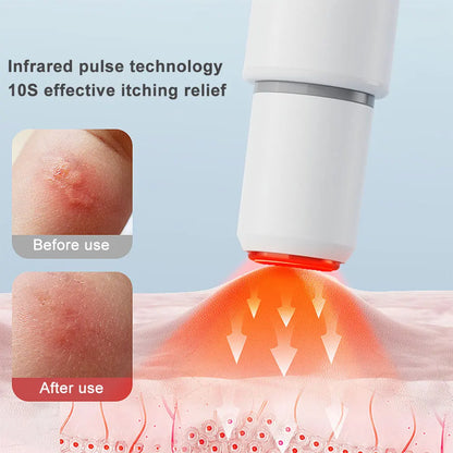 Portable Mosquito Bite Relief Heat Pen