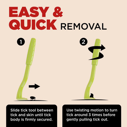 4-in-1 Tick Removal Tool Set
