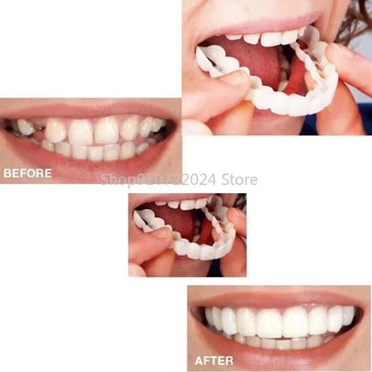 Silicone Teeth Cover Set