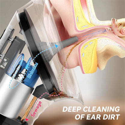 Electric Water Powered Ear Wax Removal System