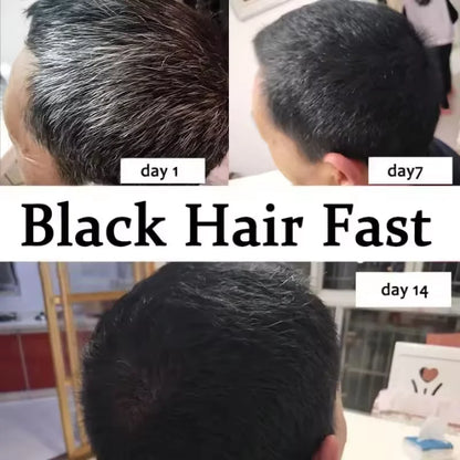 Gray Hair Treatment Serum Spray