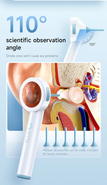 HD Digital Ear Camera Otoscope with Display
