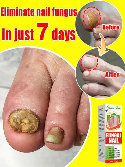 Nail Care Treatment Cream