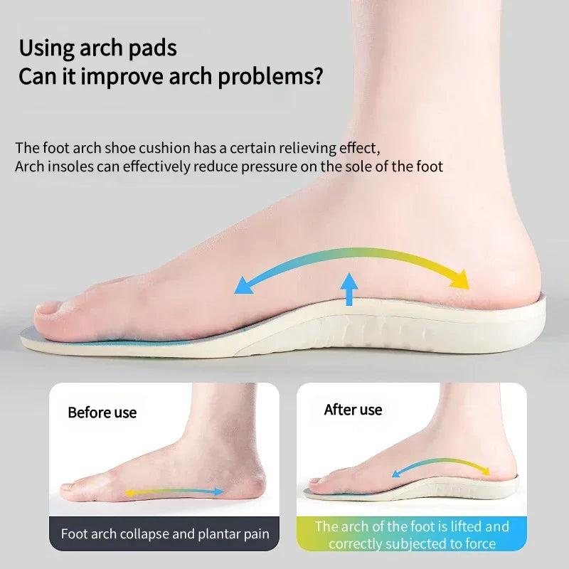 Arch Support Orthopedic Insoles
