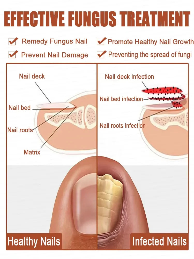 Nail Care Treatment Cream