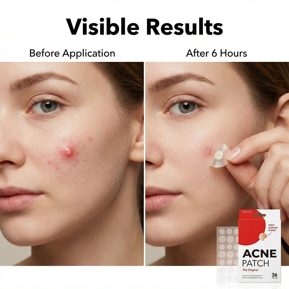 Hydrocolloid Acne Pimple Patch