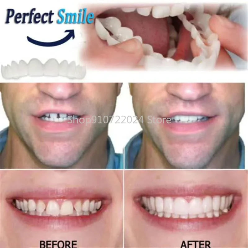 Silicone Teeth Cover Set