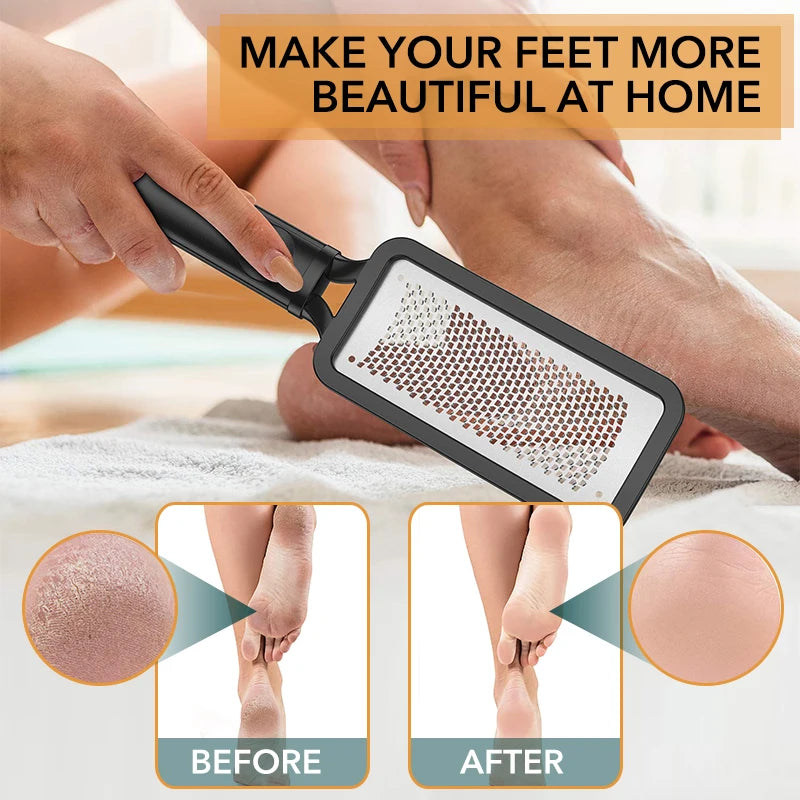 1Pc Foot Scrubber