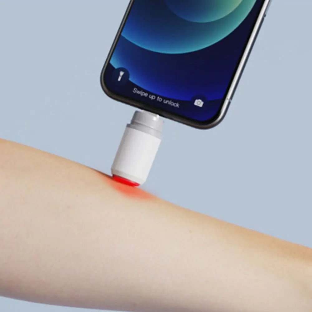 Portable Mosquito Bite Relief Heat Pen