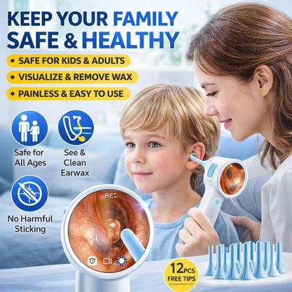 HD Digital Ear Camera Otoscope with Display