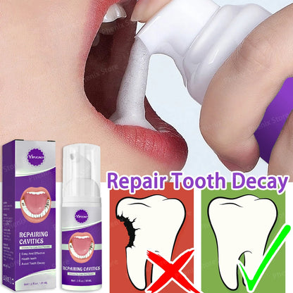 Prevent Tooth Decay Dental Caries Repair Serum