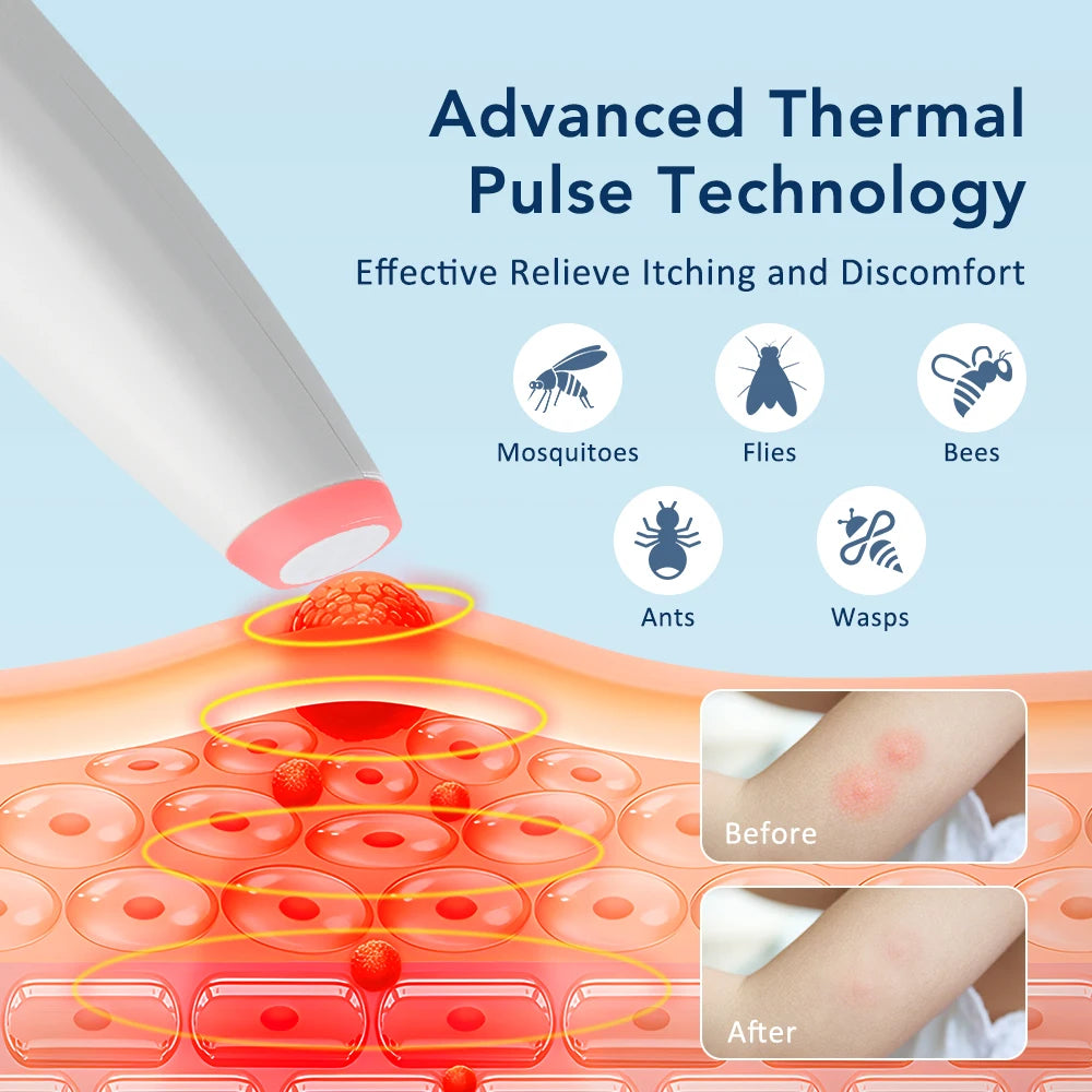 Rechargeable Portable Mosquito Insect Bite Relieve Itching Pen Chemical-Free Anti-Itch Natural Bug Bite Itch Pen for Child Adult