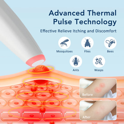 Rechargeable Portable Mosquito Insect Bite Relieve Itching Pen Chemical-Free Anti-Itch Natural Bug Bite Itch Pen for Child Adult