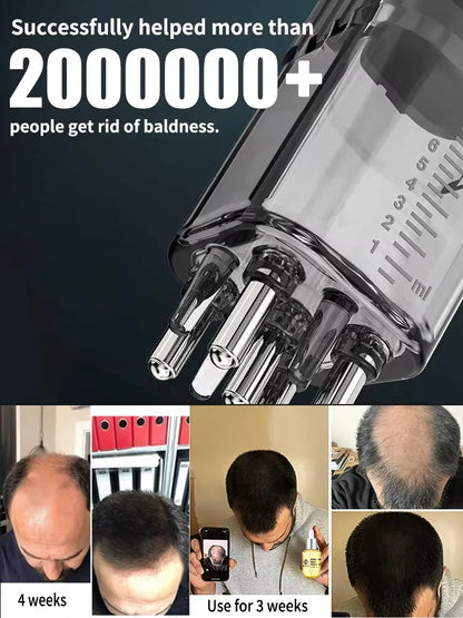 Hair Growth Applicator Massage Comb